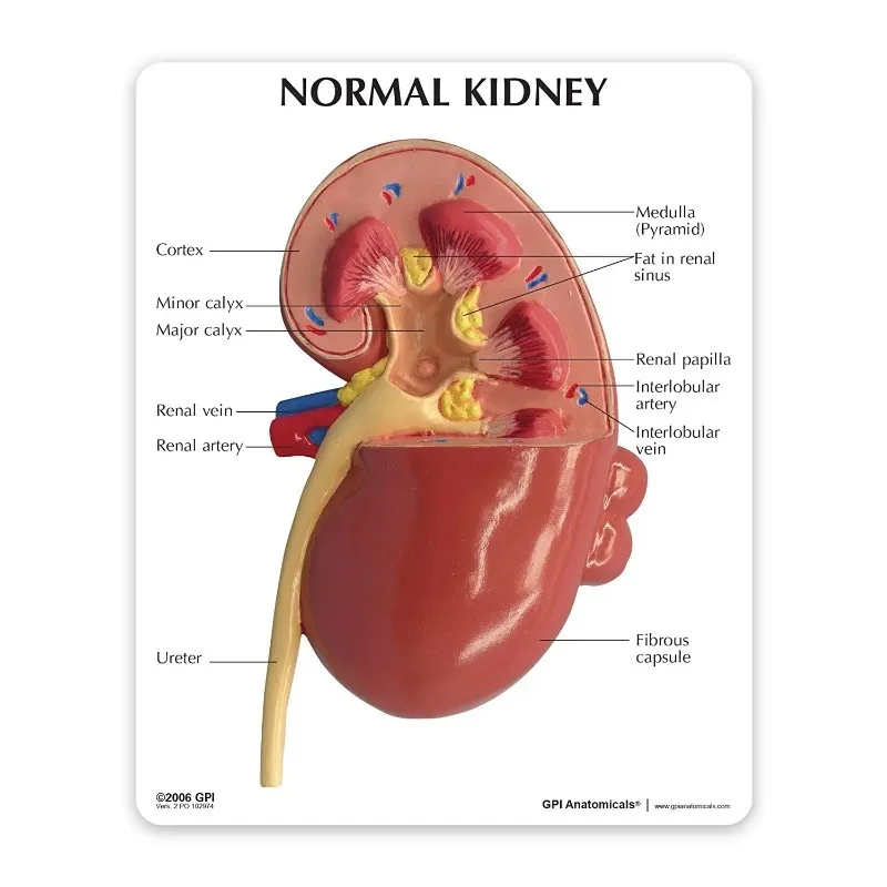 Anatomy Normal and Diseased Kidney Pathologies Medical Science Anatomical Model Human Body  Doctors Educational Tool