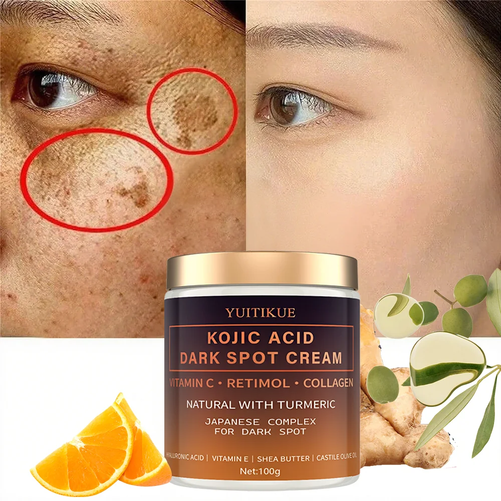 Creme desbotado de arbutina, vitamina C, retinol, colágeno, curcina natural, ácido hialurônico, vitamina E, manteiga de karité, óleo de oliva de rícino.