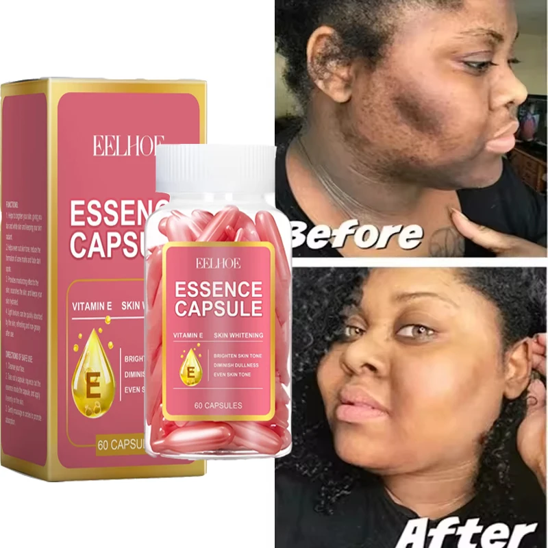 

Vitamin E Dark Spots Remover Capsule ﻿Face Freckle Melanin Correct Anti Pigmentation Brighten Beauty Korean Day Night Skin Care