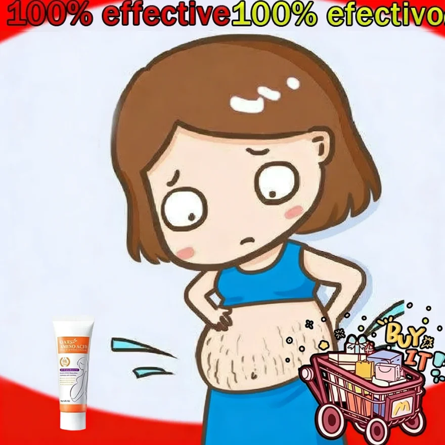 

Stretch Marks Removal Cream Light Lines Postpartum Obesity Pregnancy Powerful Fast Absorption