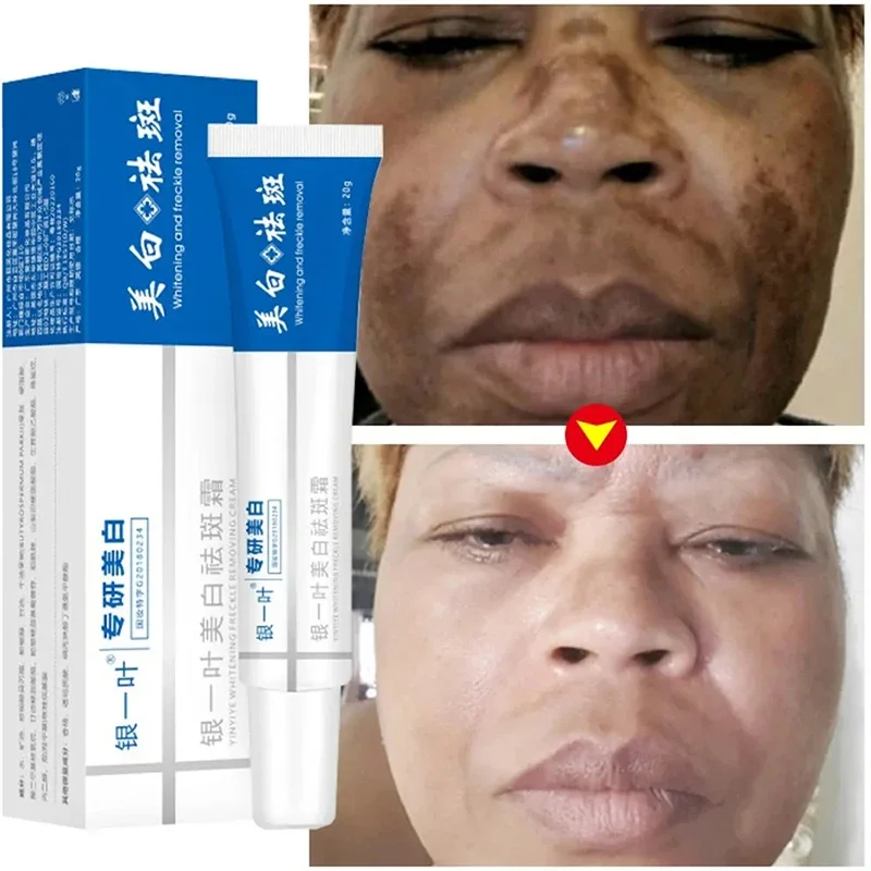 Effective Whitening Spot Cream Remove Melasma Dark Spot Cream Whiten Smooth Fading Melanin Moisturising Beauty Facial Skincare ﻿