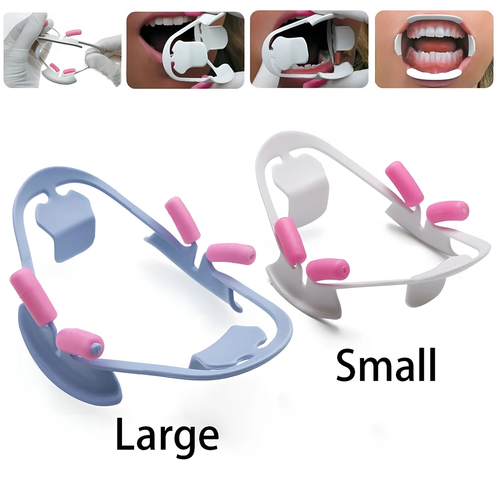 3D Oral Dental Mouth Opener Dental Instrument Lip Retractor Orthodontic Professional Dentist Tools Dentistry Materials