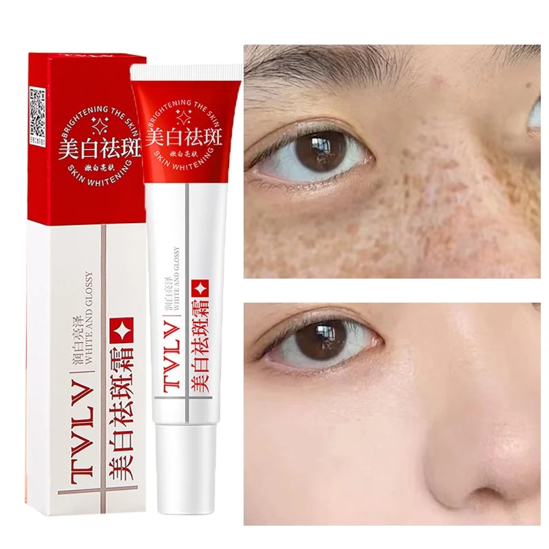 Whitening Freckle Cream Melasma Dark Spots Pigmentation Removal Products Fade Stain Melanin Repair Brighten Korean Skin Care