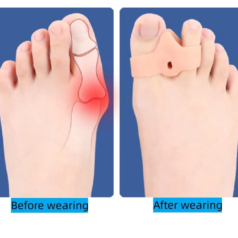 1pair Silicone Toe Spreader Separator Bunion Hallux Valgus Corrector Thumb Finger Correction Straightener Foot Care Tool