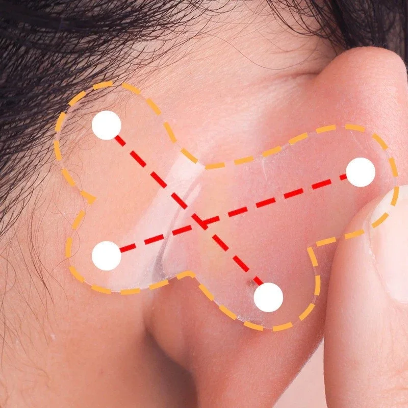 Pegatinas de oreja de elfo, parche de corrección de lóbulo de oreja Invisible reutilizable en forma de mariposa, cinta impermeable de silicona para parche de soporte de oreja