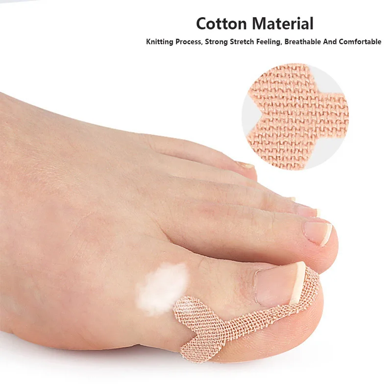 Improve Toe Embedded Nail Groove Relief Paste And Correct Nail Curling