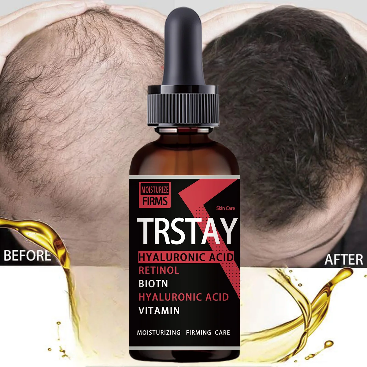 Fast Hair Growth Oil Hair Regeneration Essence Hair Thinning Treatment Hair Growth Fluid Anti-Hair Loss Care for Men and Women