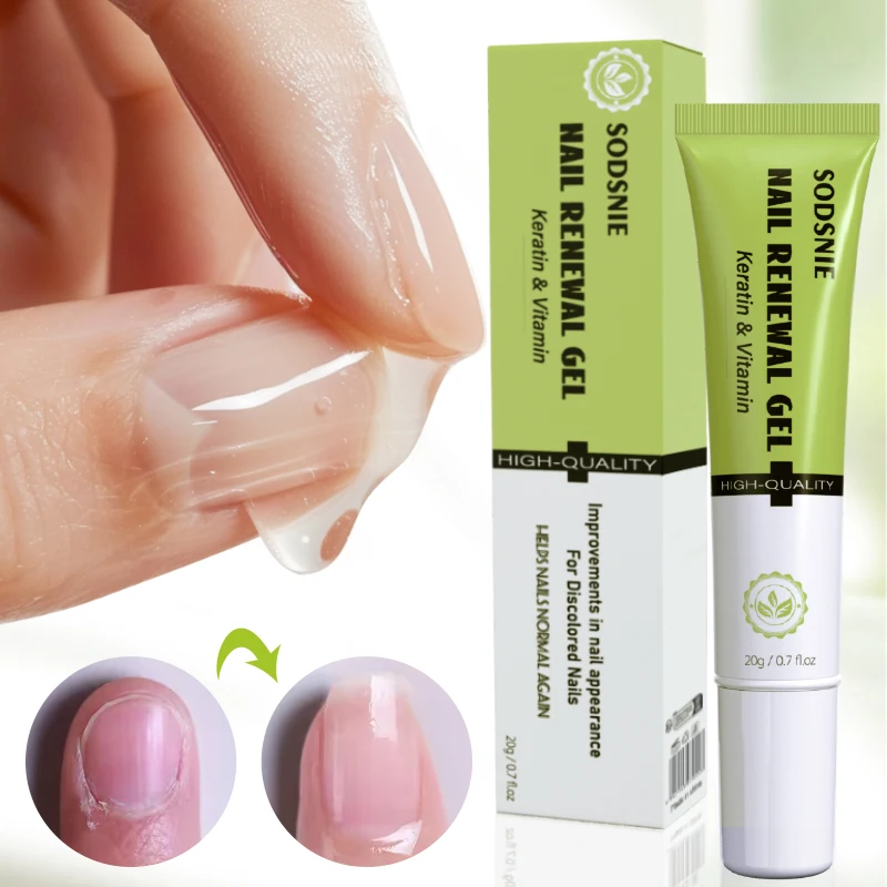 Vitamin E Nail Renewal Gel For Thin Nails Growth And Strengthening Serum Nourishing Repair Damaged Nail Healthy Nail Care 20g