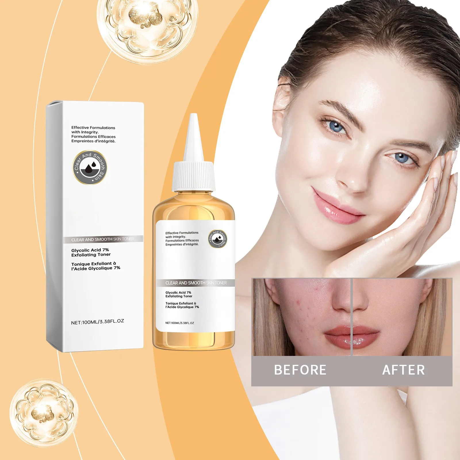تونر مقشر بحمض الجليكوليك 7% 100 مل - محلول حب الشباب للعناية بالعشب وتقليل المسام وتفتيح البشرة وتقشير لطيف