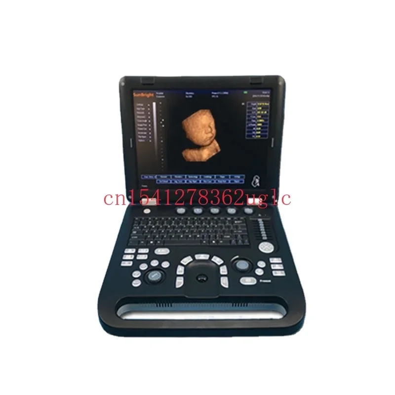 

Ecocardiografia portдвижущаяся Высококачественная OB GYN 3D 4D Ecocardiografia SUN-800D