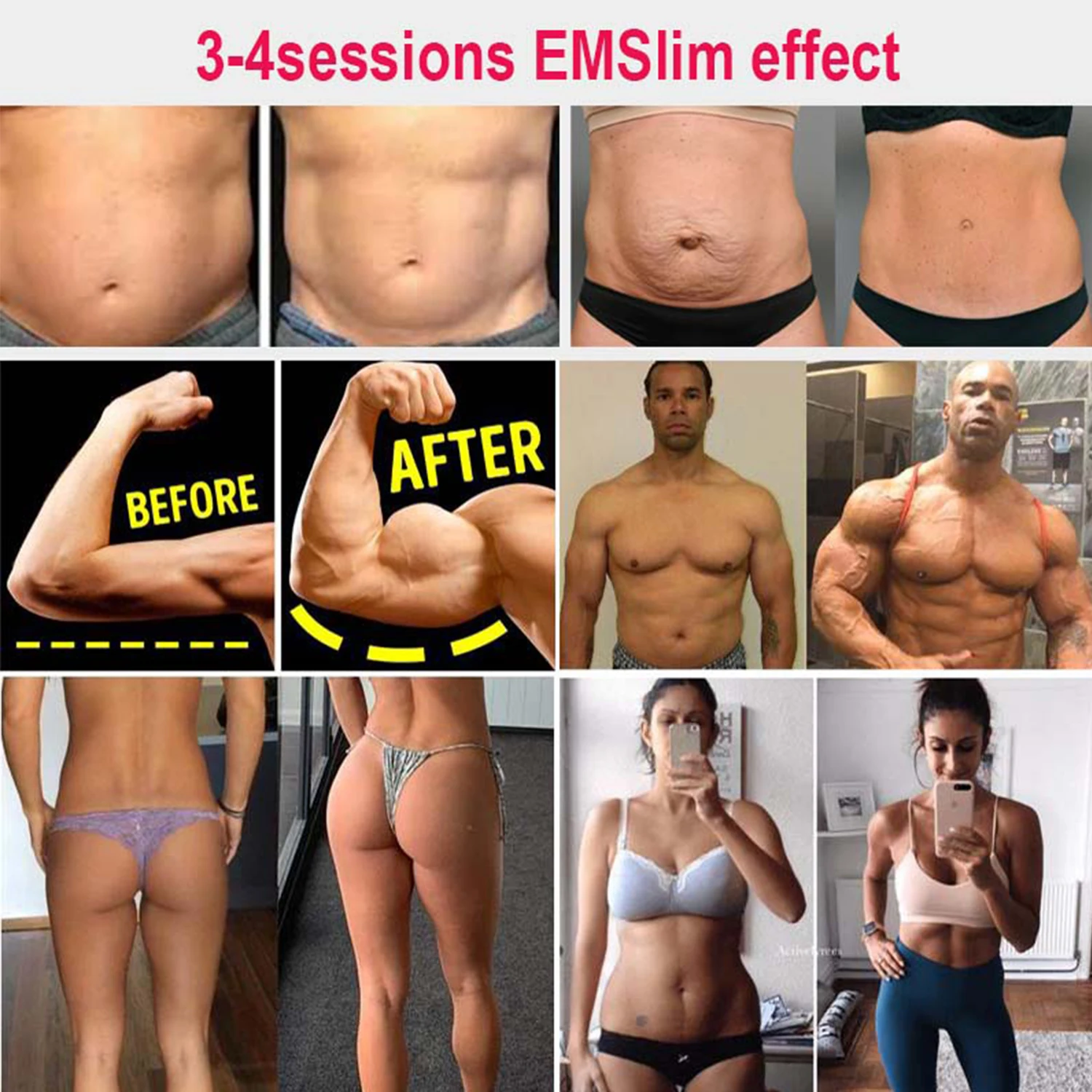 테슬라 Ems 무게추 손실 조각 기계, 지방 연소, Renasculpt Ems 조각 기계, 15