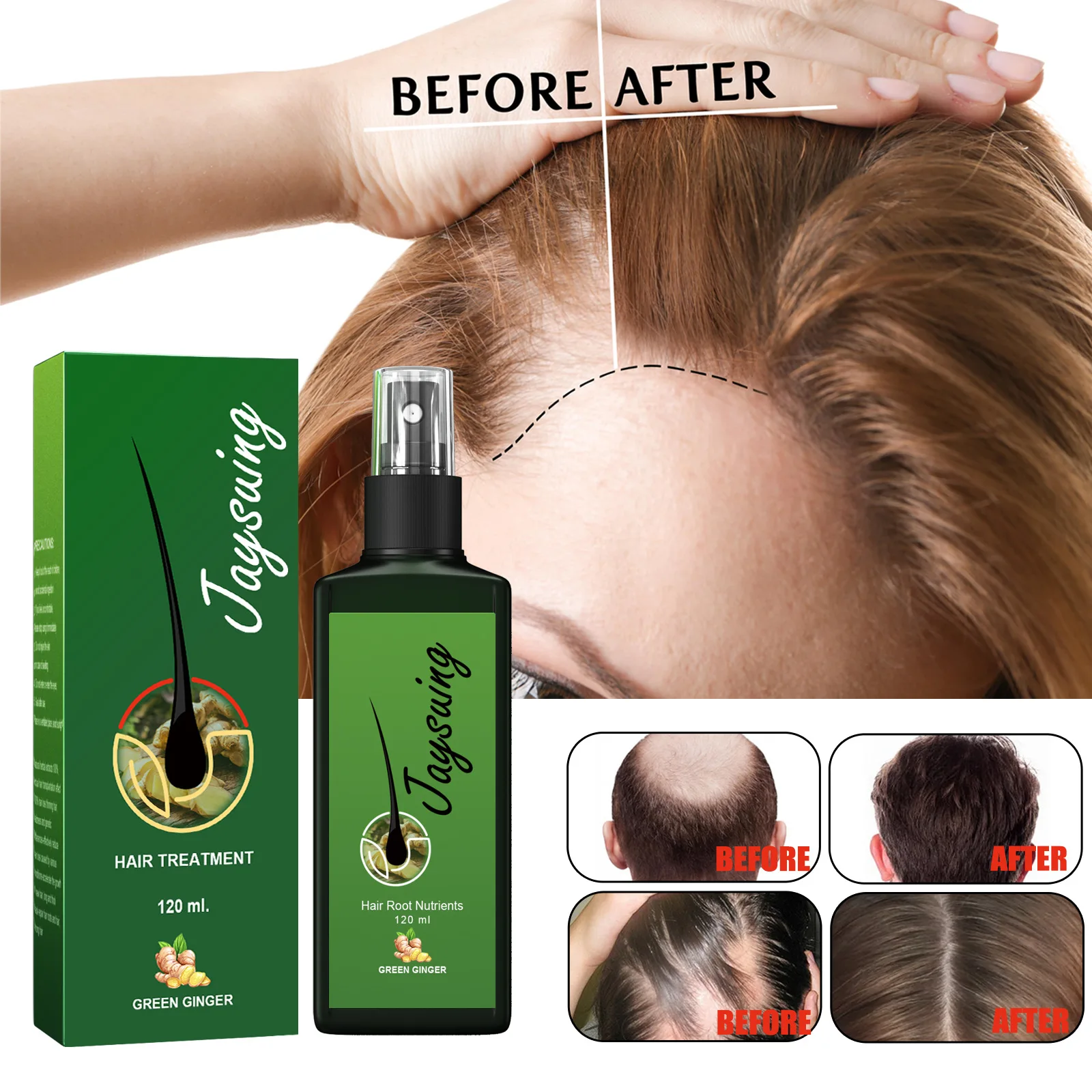 

Jaysuing Hair Conditioner strengthens hair, nourishes root growth and thickens scalp massage nutrient solution，30ml/120ml