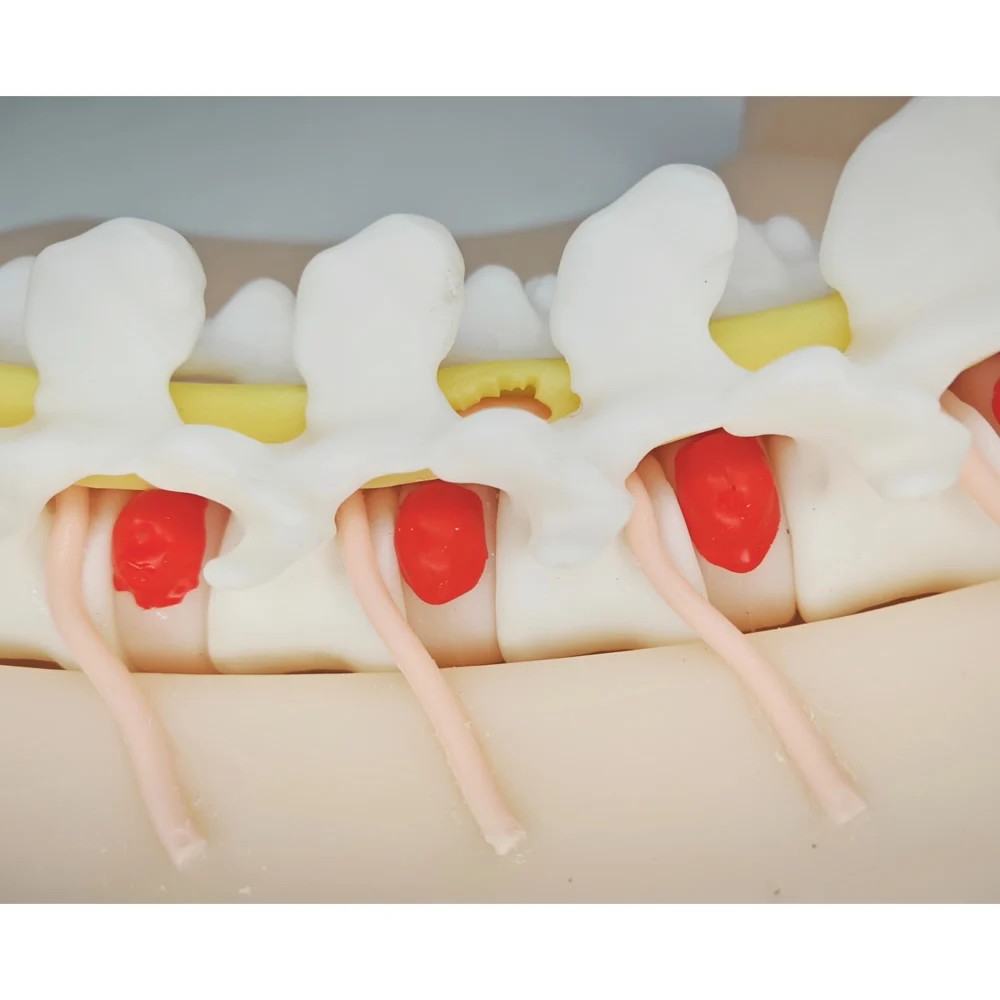 Intervertebral Foramen المنظار التدريب UBE الجراحي محاكي التشغيل تحت الماء المنظار عالي الدقة ثنائي الغرض