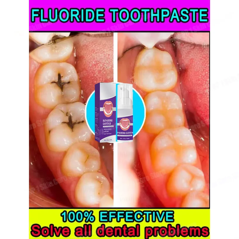 

Hot sales Best-selling, Scientific Repairs Cavities, Removes Cavities, Cleans Plaque, Whitens Teeth, and Freshens Breath