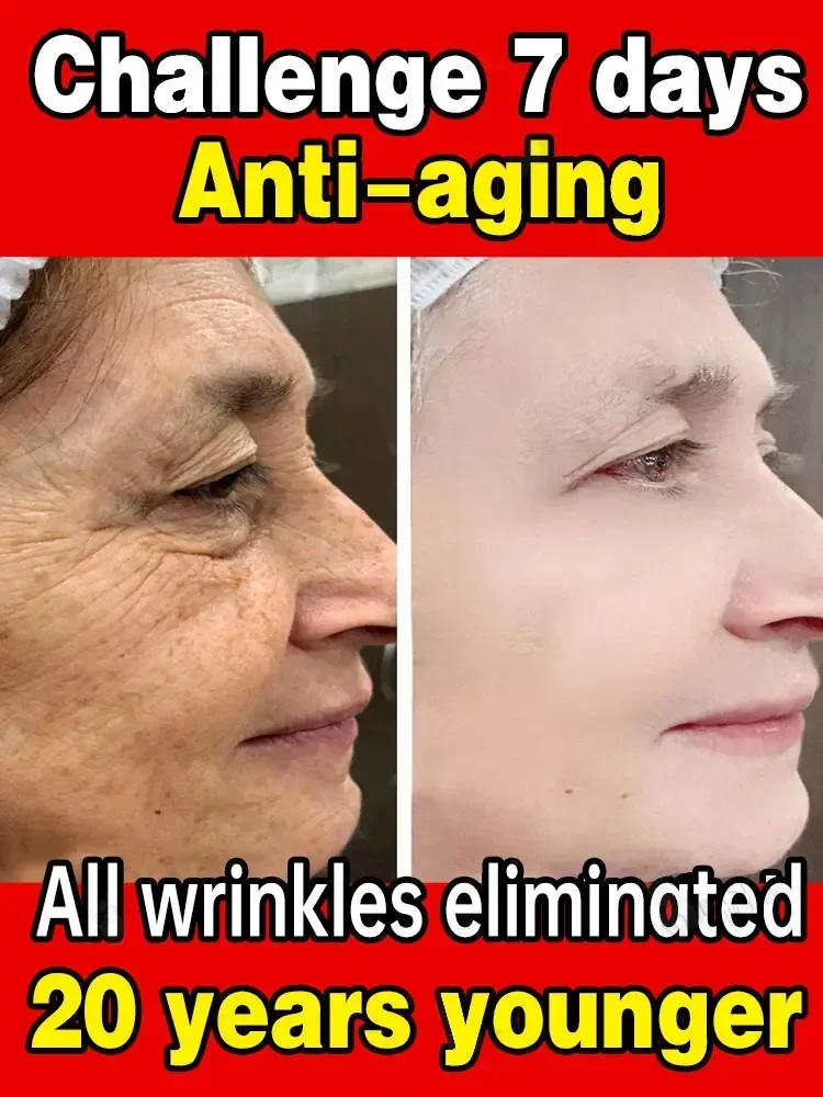 Gesichts feuchtigkeit creme Anti-Aging-Serum Anti-Falten-Gesichts serum entfernen Falten feine Linien um die Augen Krähen Füße Hals falten