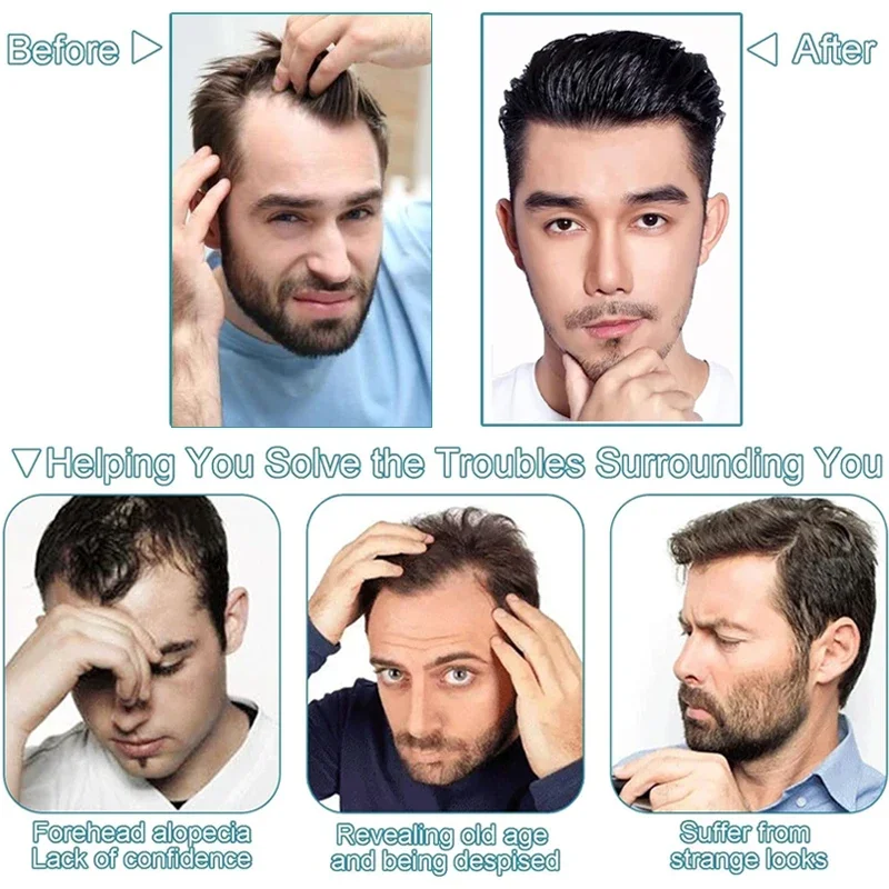 Antimikrobielles Vstyle Herren-Toupet Dünne Haut Vollständig PU 0,08-0,12cm V-Loop Frontperücke Echthaar-Perücken für Männer Unsichtbare Natürliche Haarlinie – Detail 14