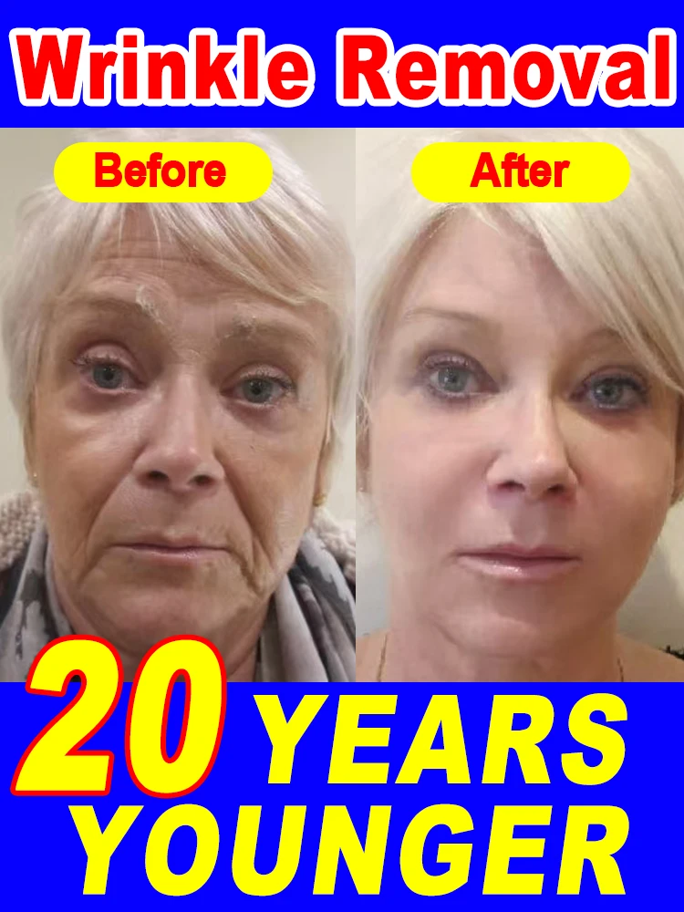

20 years younger，wrinkles disappear