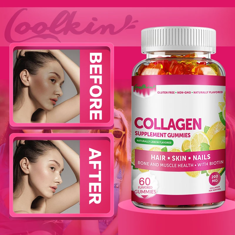 

Collagen Gummies - Supplement Natural Energy, Support Cell Health, Anti-aging, Antioxidant, Skin, Joints, Hair, Bone Health