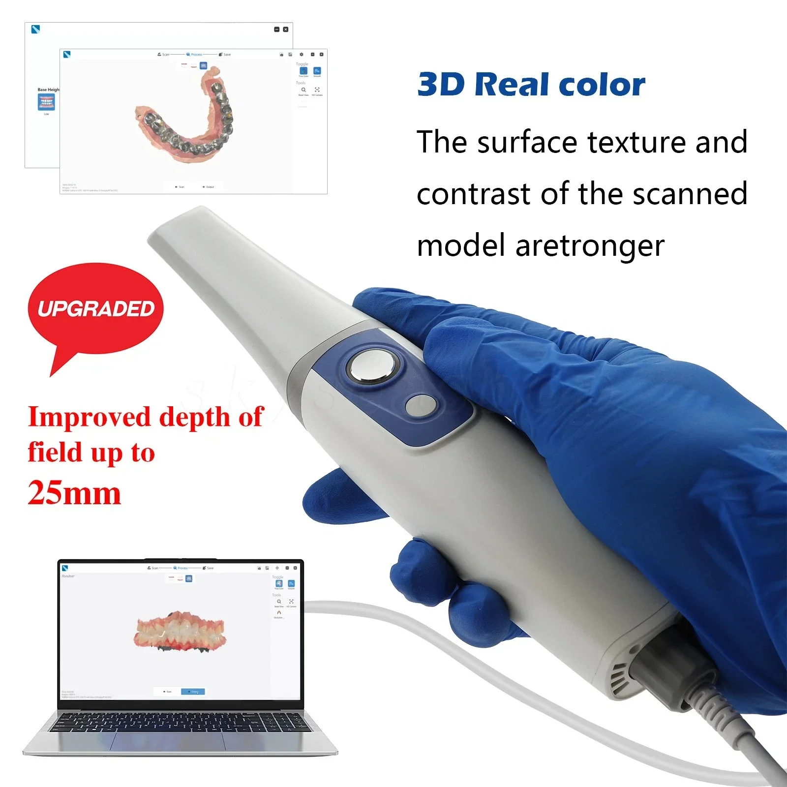 Dental Intraoral 3D Scanner Real Color Digital Impression System Remote Sensing 4 Tips AI Scanner Compatible with CAD CAM Restor