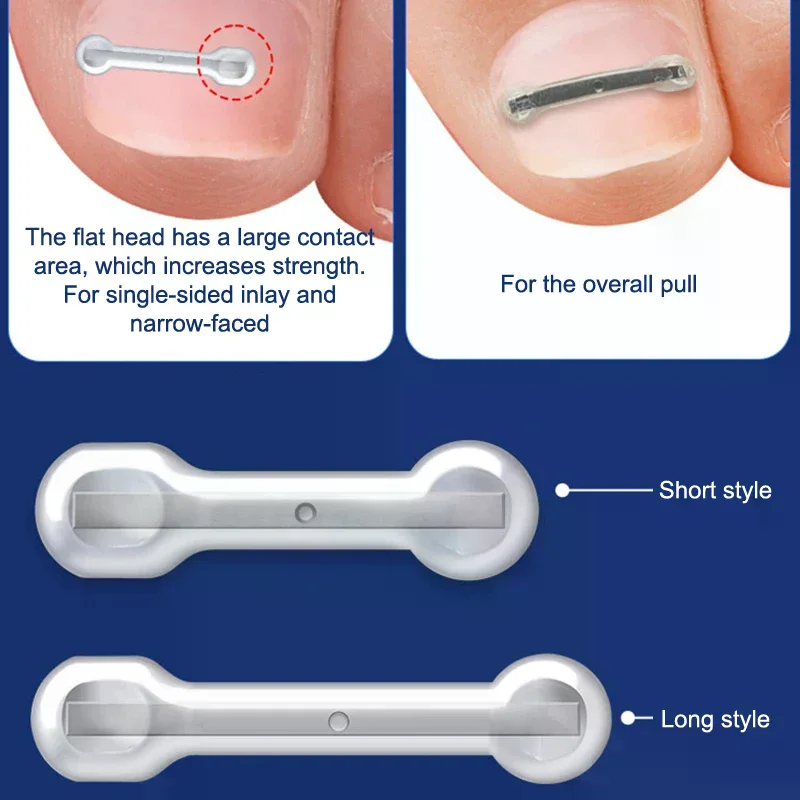 12個のチタン合金陥入爪治療キット - ペディキュアケア用の4つのマルチサイズ湾曲爪矯正ツール