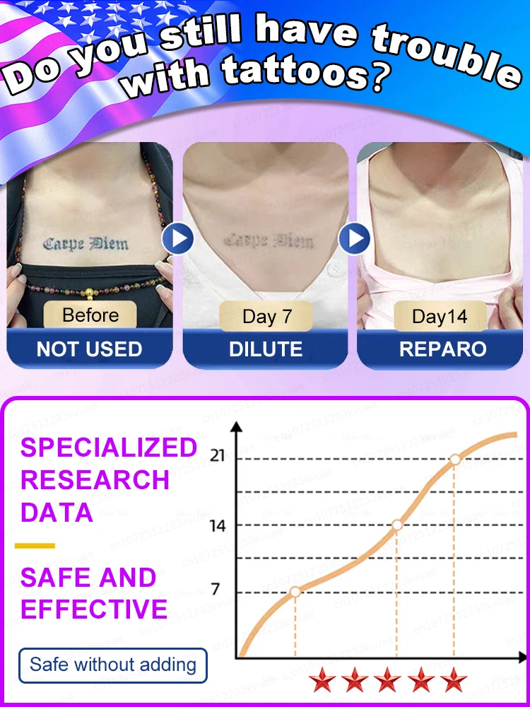 Tattoo Removal Cream And Spray Best Sell