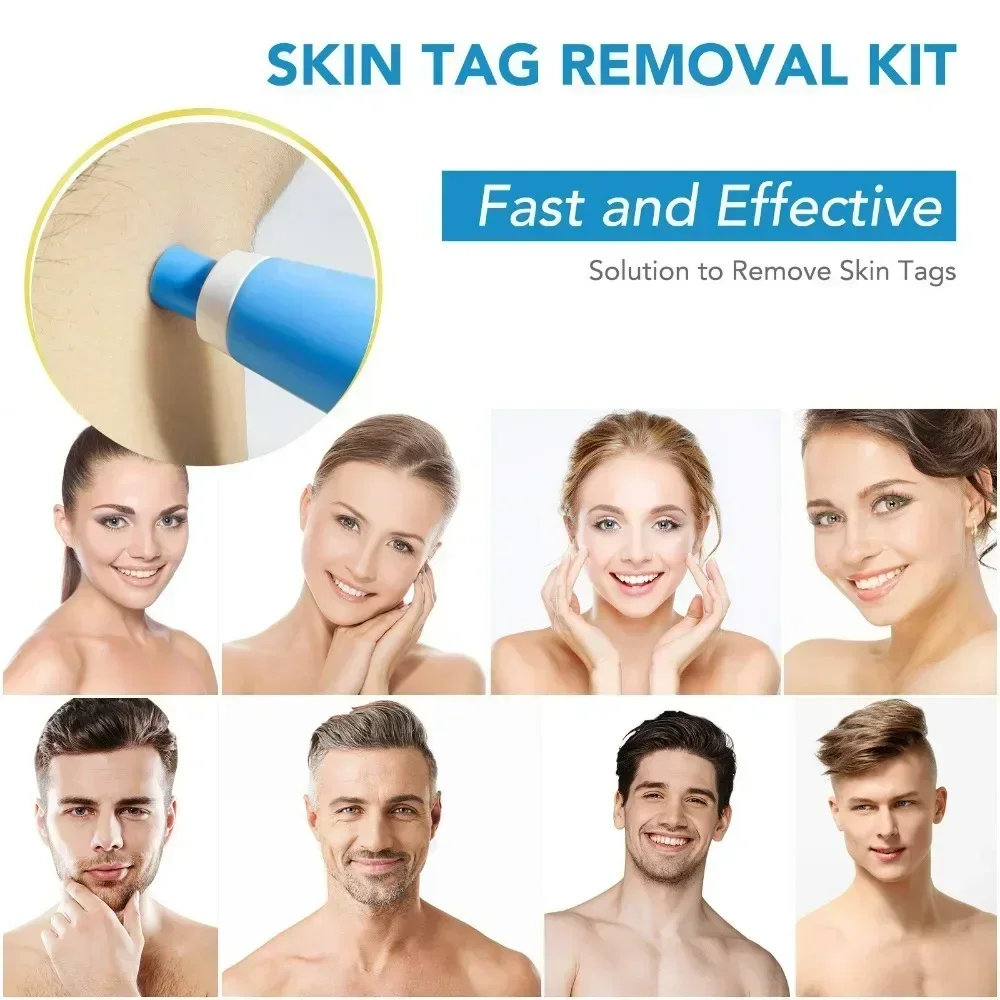 2 IN 1 Auto Micro Skin Tag Remover Device Standard And Micro Skin Tag Removal Kit Adult Mole Wart Remover Face Care Beauty Tools image 2
