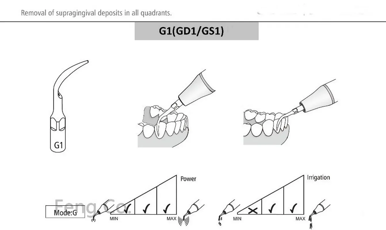 GD1 Dental Ultrasonic Scaler Tips Scaling  Endo Perio fit SATELEC NSK DTE GNATUS HU-FREIDY Handpiece Dentist Teeth Whitening