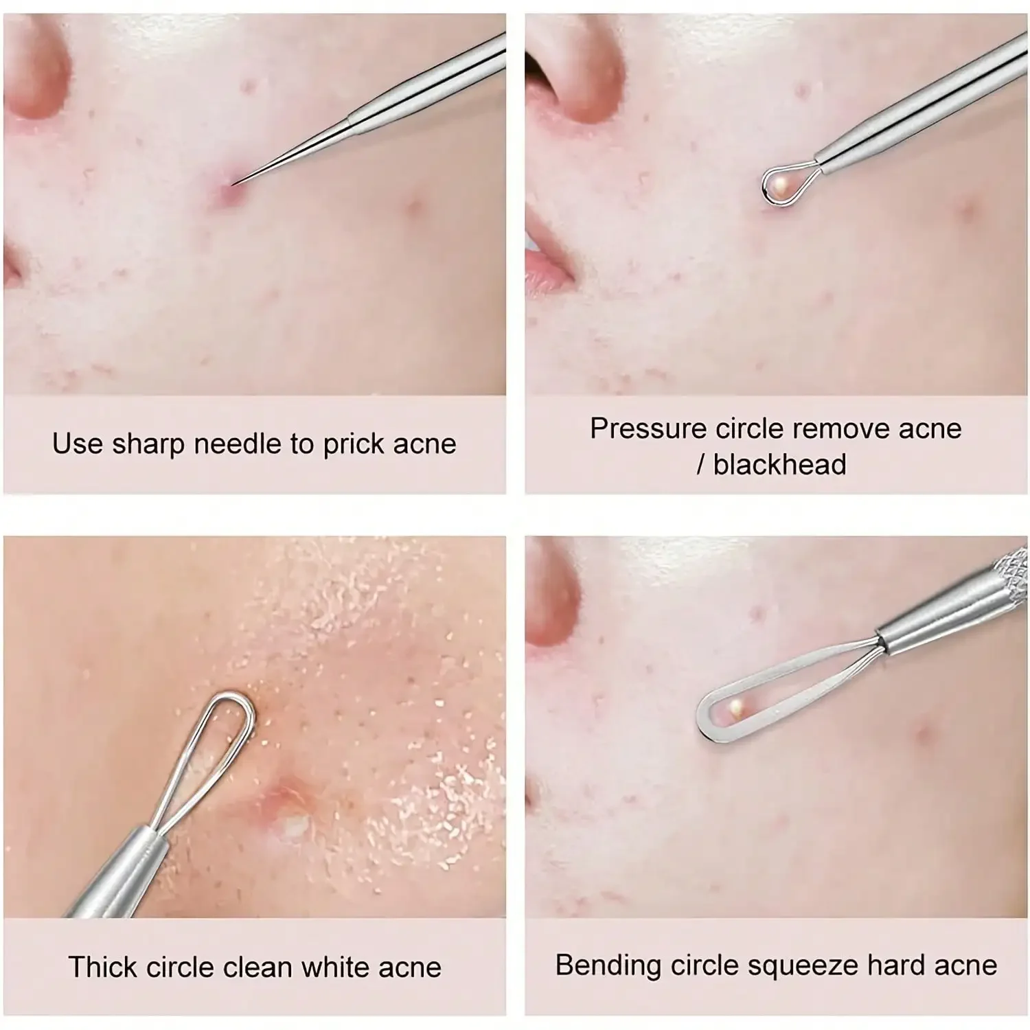 Kit d'outils professionnels pour éliminer les points noirs d'acné, pincettes et aiguilles de précision en acier inoxydable pour la beauté du visage, élimination des points blancs