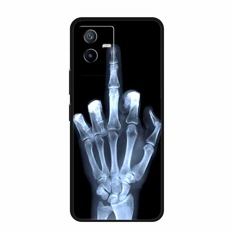 Luxury Original Phone Case for VIVO IQOO Z8 Fashion Protective Back Cover TPU Soft Silicone for vivo iQOO Z9 Capa vivo iQOOZ8 image 6