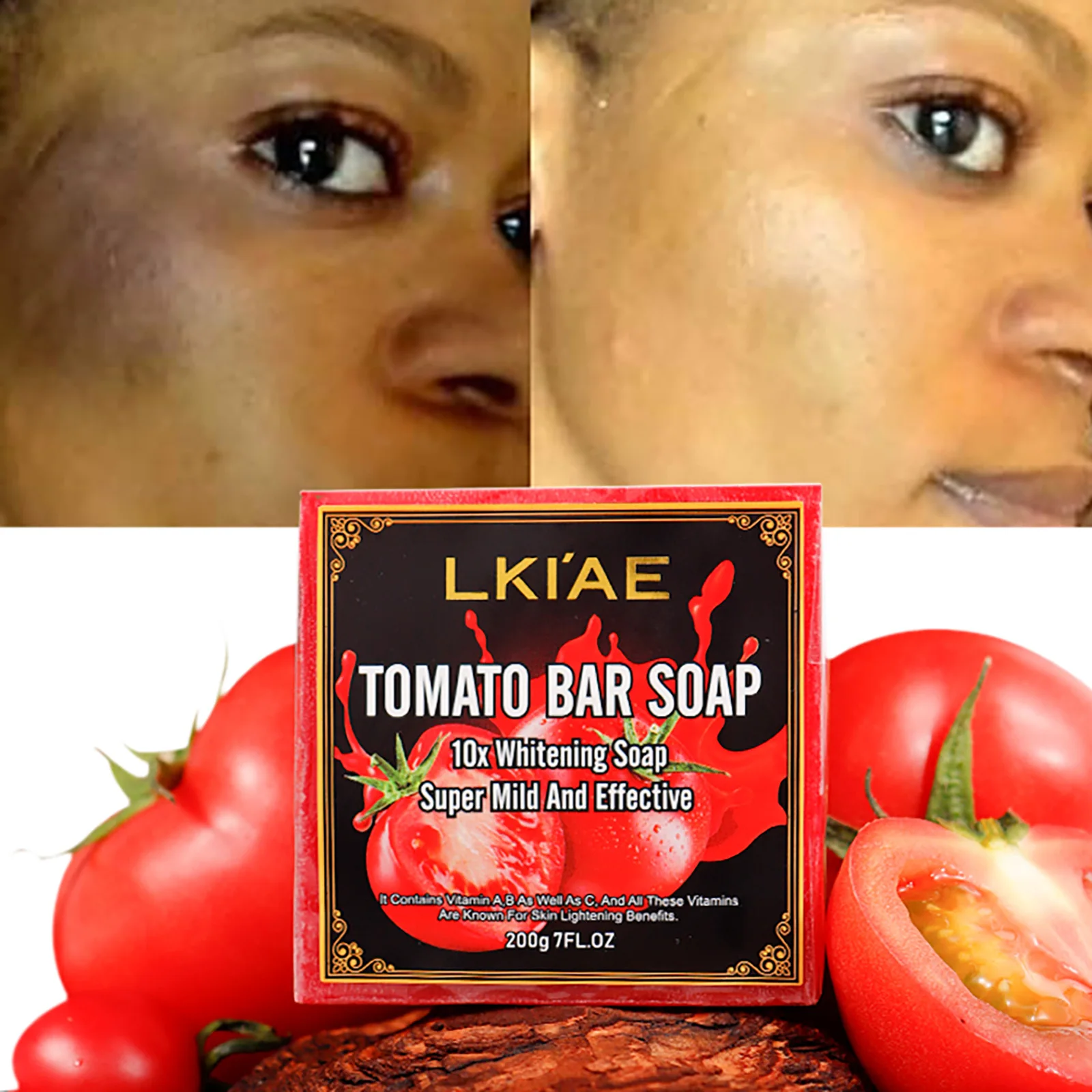 LKIAE – savon en barre naturelle parfumé aux fruits et tomates, fait à la main, pour le visage, le corps, le blanchiment, le contrôle de l'huile, éclaircit, rétrécit les pores, 200g