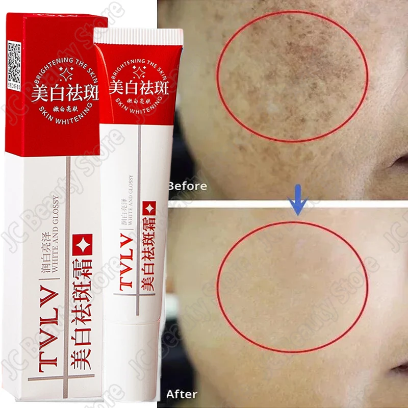 

Whitening Freckle Cream Melasma Dark Spots Pigmentation Removal Products Fade Stain Melanin Repair Brighten Korean Skin Care