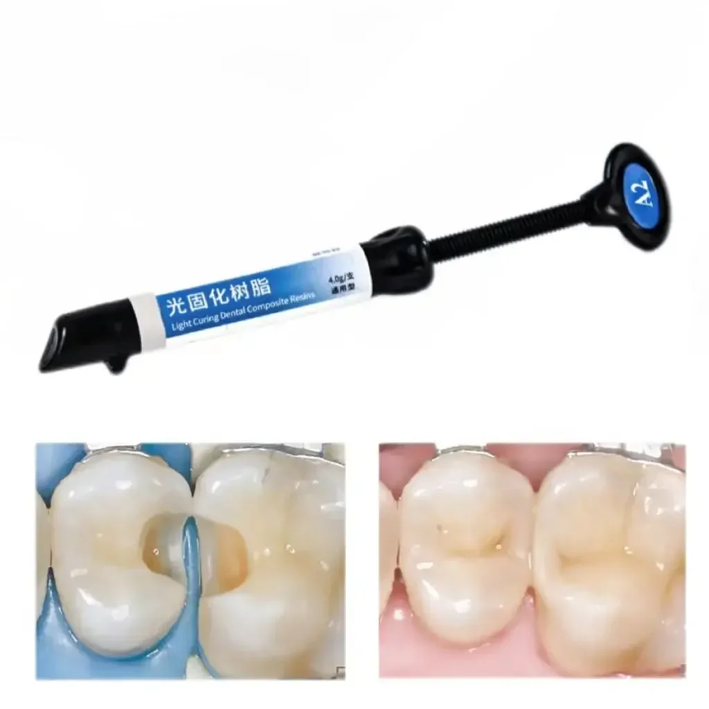 Dentex dental light-curing adhesive universal aesthetic composite resin/adhesive/acid etching gel kit orthodontic bracket