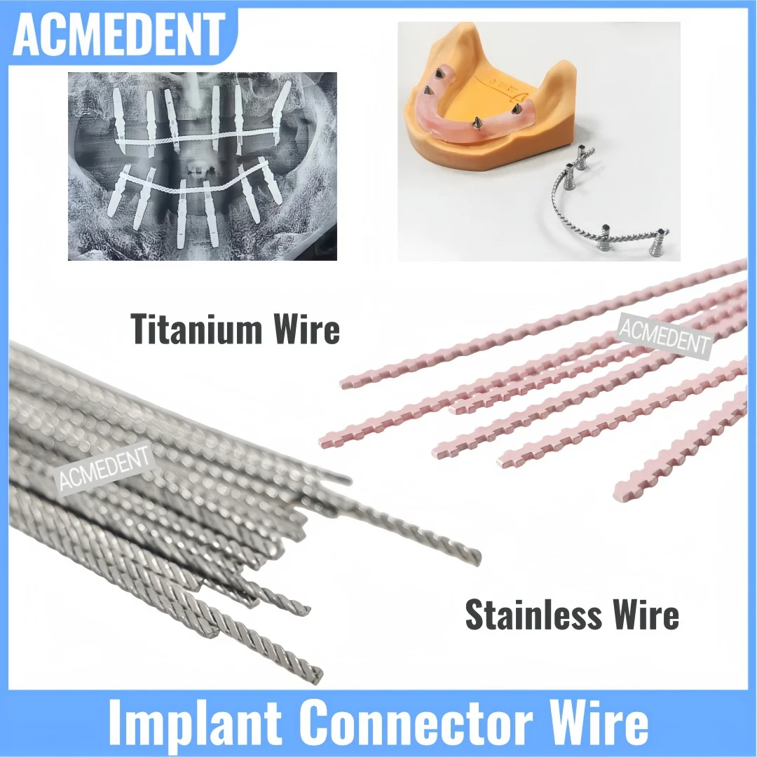 

5-100Pcs Dental Implant Connector Wire Stainless Tianium Strengthener Twist Wires Strengthening Wire Retained Overdentures MU