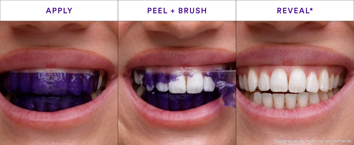 No Peroxide Fast Tooth Whitening Strips