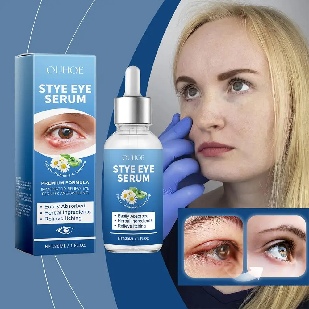 30ml Eye Swelling Relief Essence Relieves Eye Redness Swelling Stye Anti Fatigue Dry Itchy Around The Eyes Moisturizing Serum