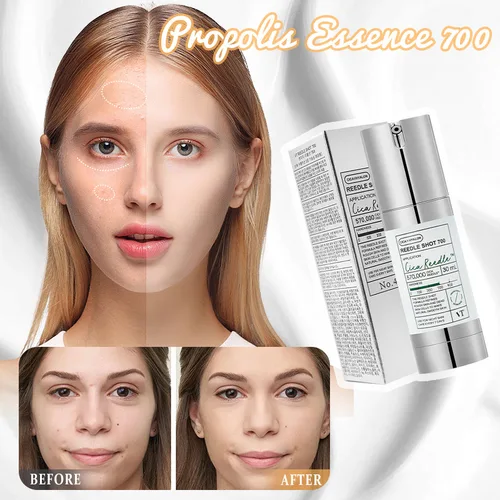 Imagen 2 del producto Centella Asiatica Reedle Shot Spicule Microneedling suero exosome acné imperfecciones cuidado de los poros exfoliación, potenciador de la piel líquido coreano
