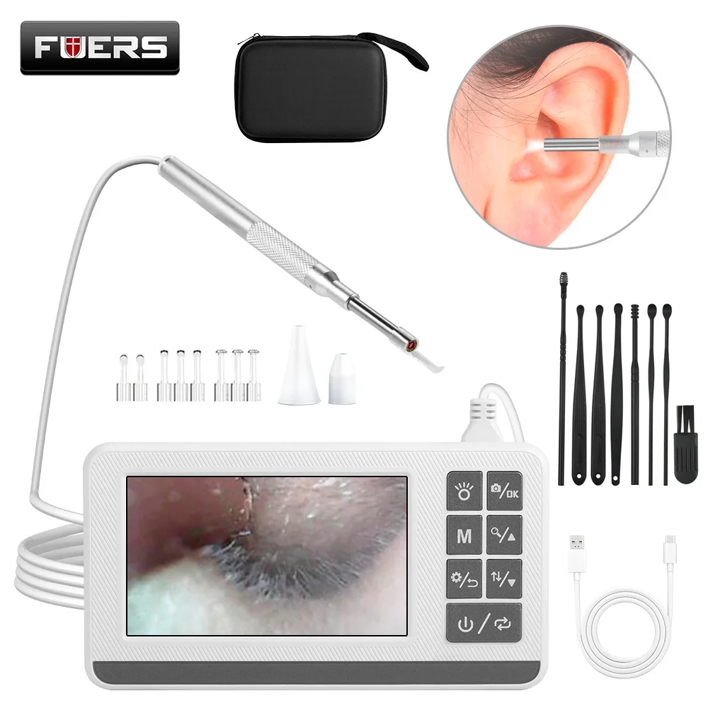 

FUERS Ушная эндоскопическая камера 4,3-дюймовый полноцветный ЖК-экран Ушной отоскоп с подсветкой Ушная камера с инструментами для удаления ушной серы