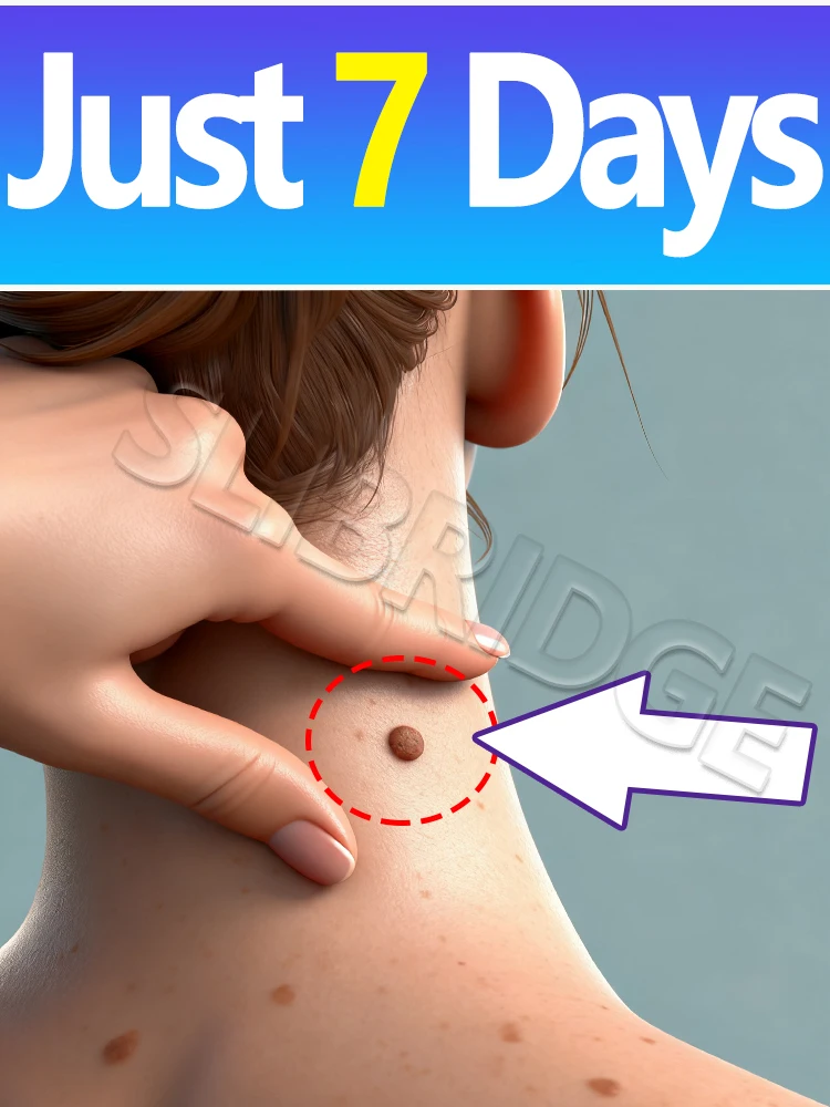 Technology changes life and Bestselling body tools, wart removal body tools, little blue bottle Free shipping,Unisex