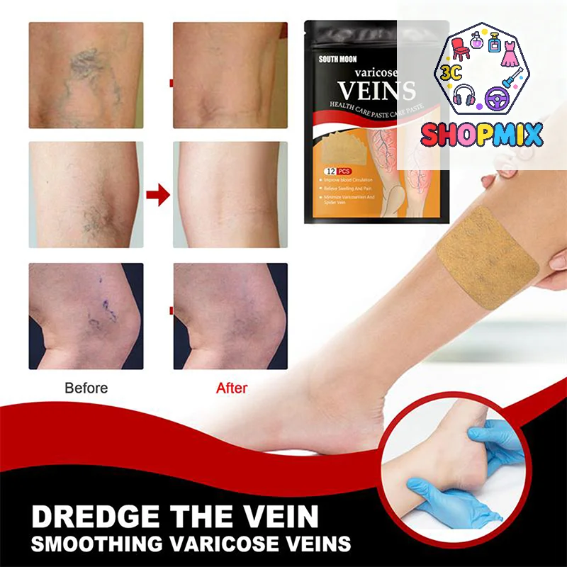 

12PCS/Bag Unisex Varicose Veins Treatment Patch Legs Sore Swelling Plaster Promote Metabolism Promote Smooth Blood Circulation