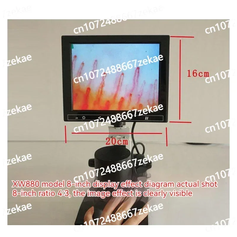 High-Definition Digital Microscope for Nailfold Capillaroscopy | Zoom Capillary Microcirculation Detector |
