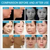 새로운 페이스 리프트 Peface V 라인 Ems 페이셜 Ems Rf 페이스 리프팅 기계 피부 강화 페이스 넥 리프팅 주름 제거 장치 6