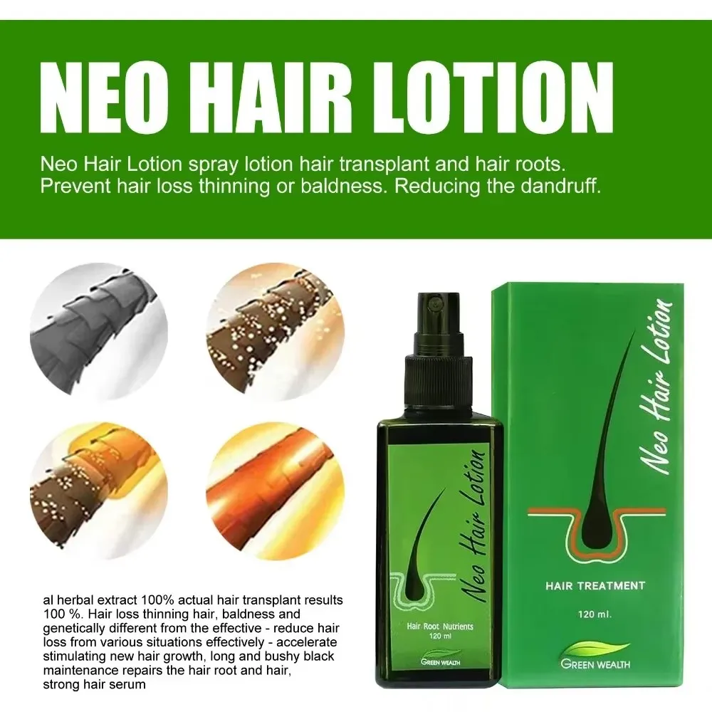 Hair Care Lotion 120 ml Hair Regrowth Treatment Growth Strengthens Damaged Hair Loss Revitalizes Scalp For Men & Women