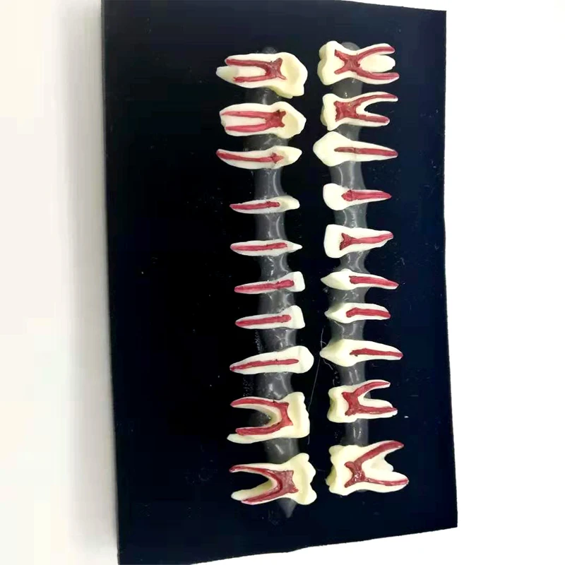 

Модель детского зуба Сборник между первичными зубами, врачами и пациентами, демонстрация первичных зубов, постоянными зубами