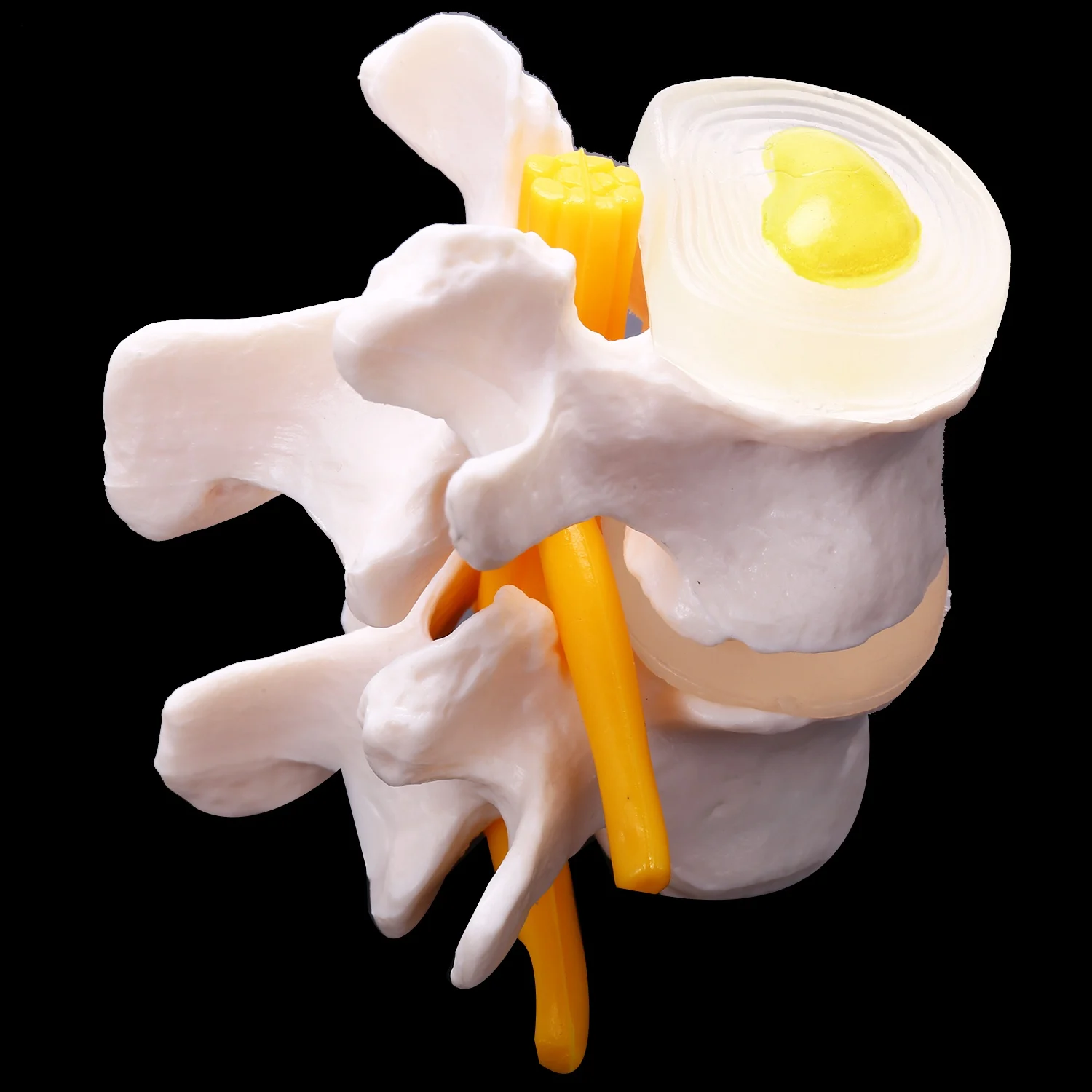 B50B-Human Anatomy Skeleton Spine 4-Stages Lumbar Vertebral Model Brain Skull Traumatic Teaching Supplies