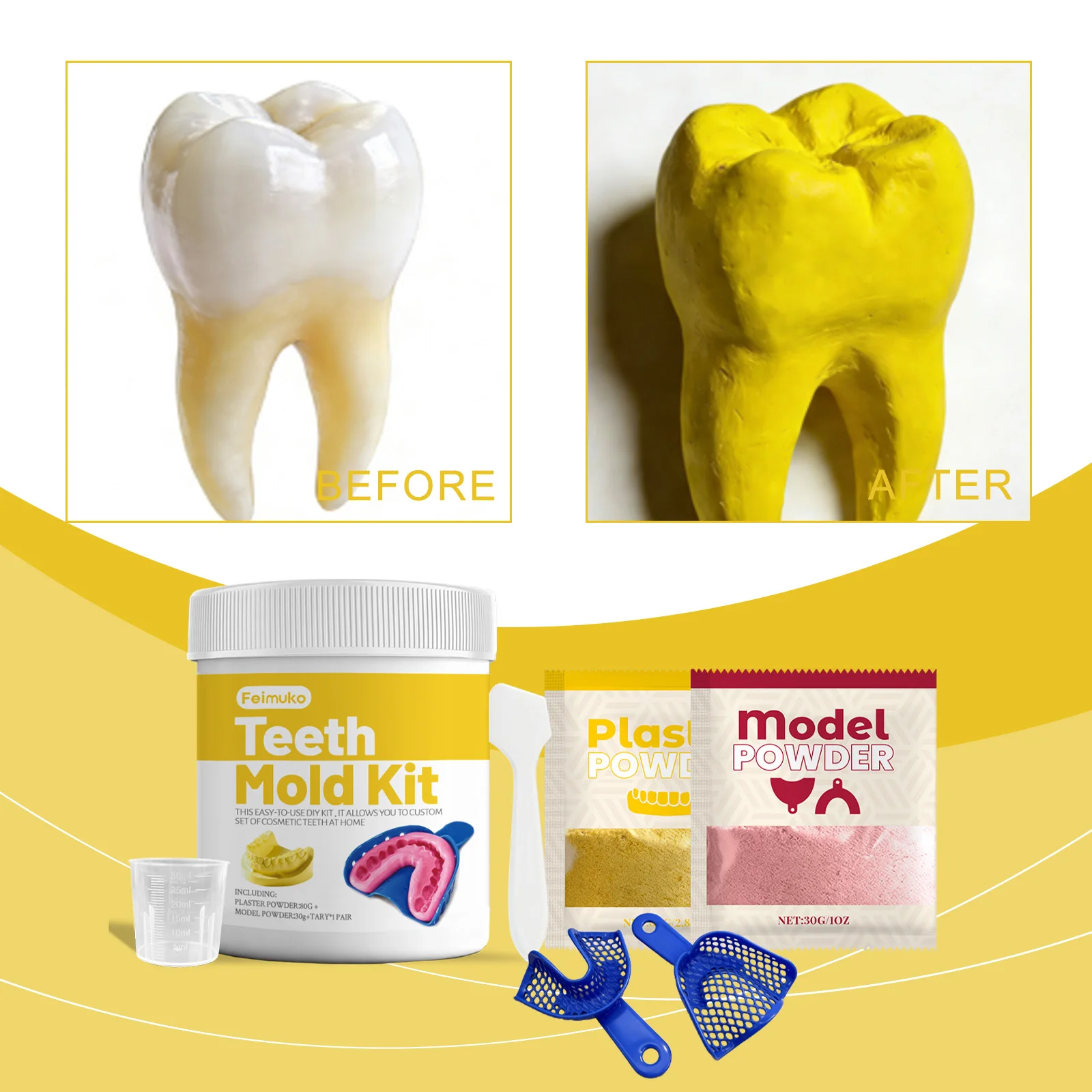 DIY Teeth Impression Gypsum Model Kit For Custom Dental Grillz Veneer Making Accurate Clear Stable Tooth Casting Material Set