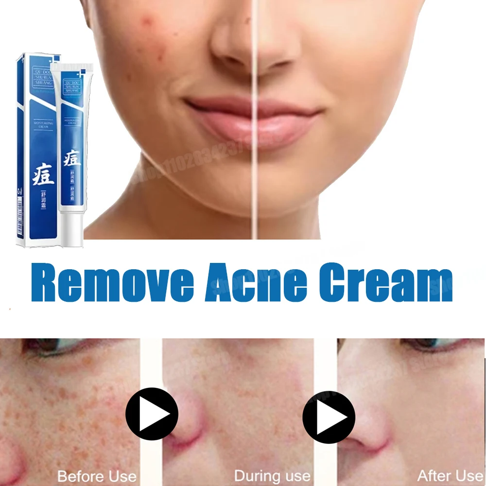 

Salicylic Acid Solution Essence Shrink pores and Acne Spot Removing Shrink Pores Oil-Control Brighten Face Skin Care