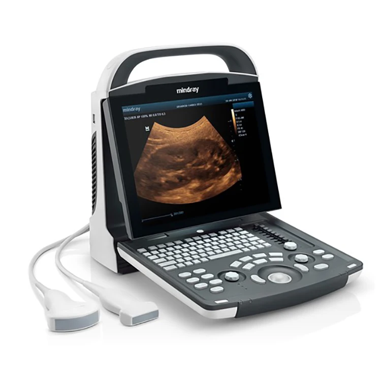 Cheapest Price Laptop Digital 2d 3d 4d Obstetric Gynecology Laptop Ultrasound Scanner