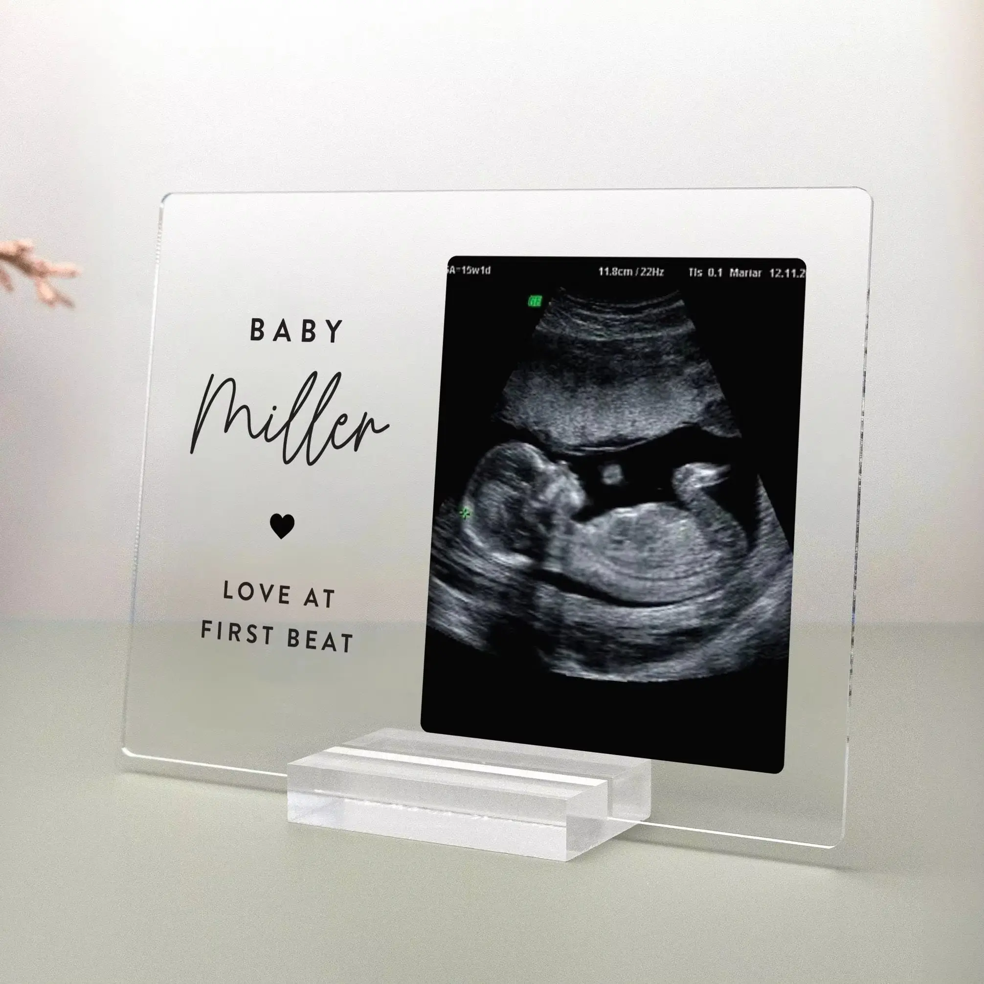 Personalized Ultrasound Photo Plaque, Baby Announcement Keepsake, Pregnancy Reveal Gift for Expecting Parents