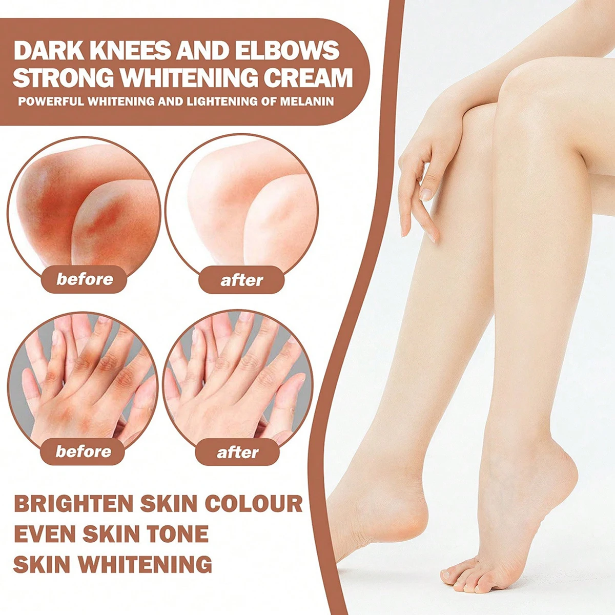 Dark colored knees and elbows effectively brighten and fade, enhancing even skin tone