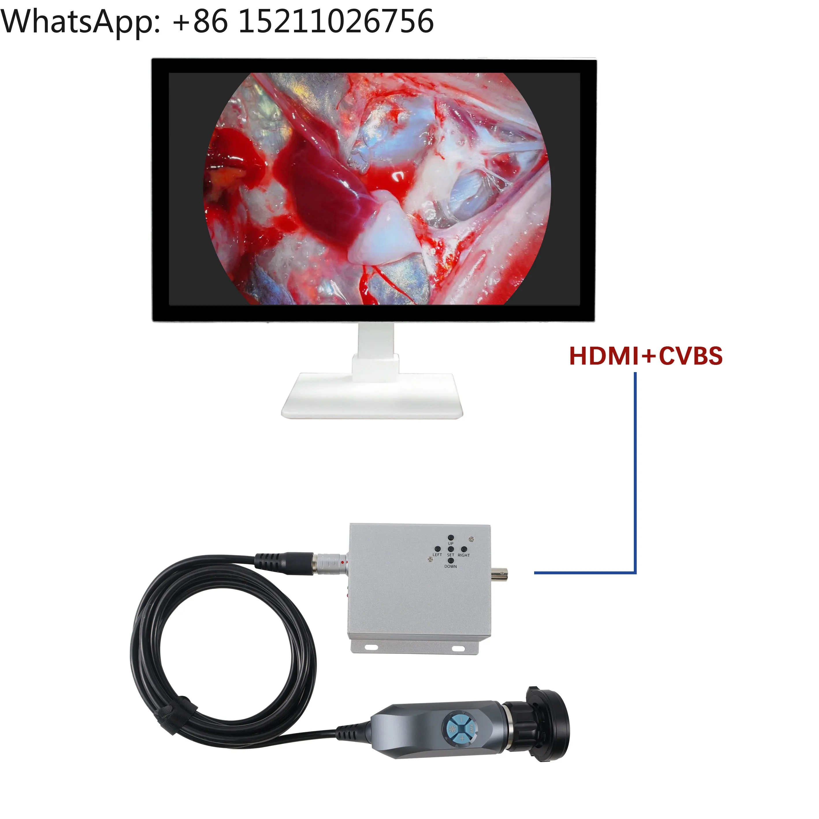 Medical Full HD 1080P Portable Endoscope Camera System with  /SDI Output for ENT Nasal Ear Otoscope
